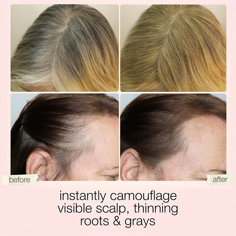 Before and after hair coverage